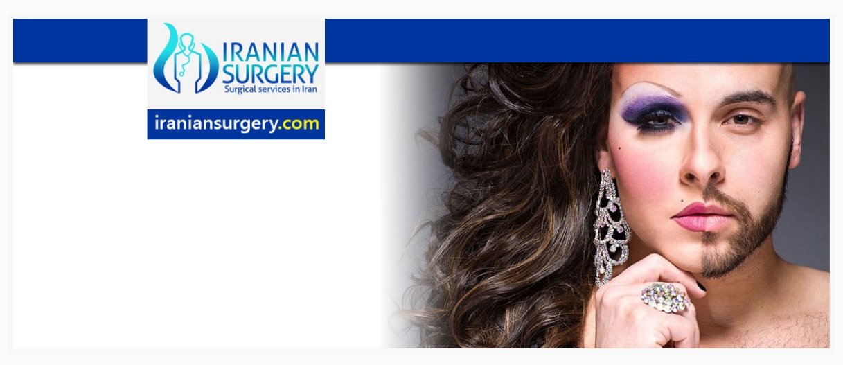 Muchos centros estéticos y médicos iraníes promueven las cirugías de reasignación de género en sus websites. Fotografía: Iranian Surgery